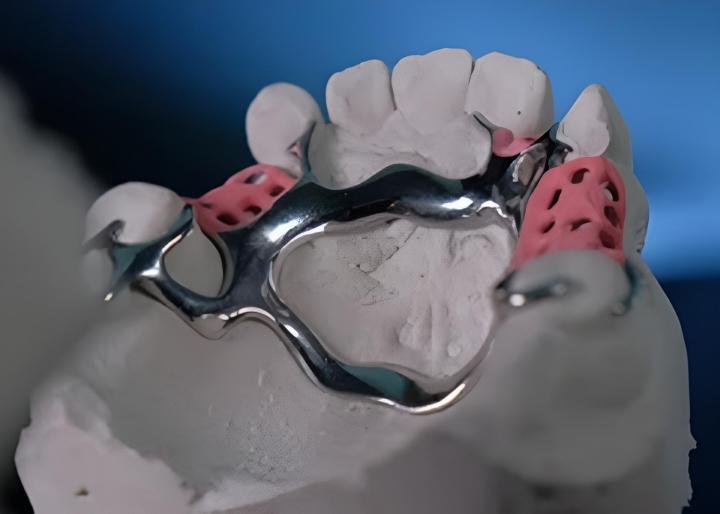 Prothésiste dentaire Castelnau-le-Lez