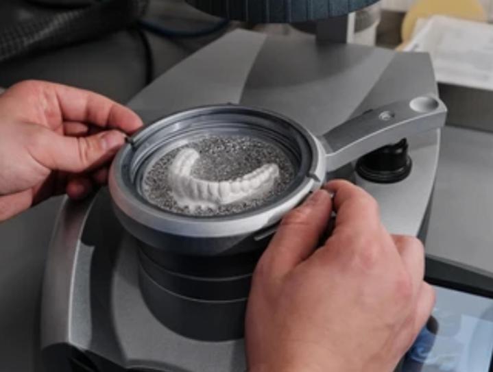 Implant dentaire céramique Castelnau-le-Lez