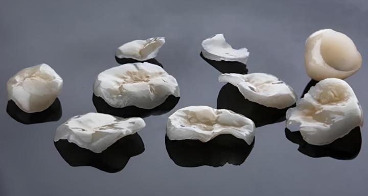 Prothèse conjointe Castelnau-le-Lez