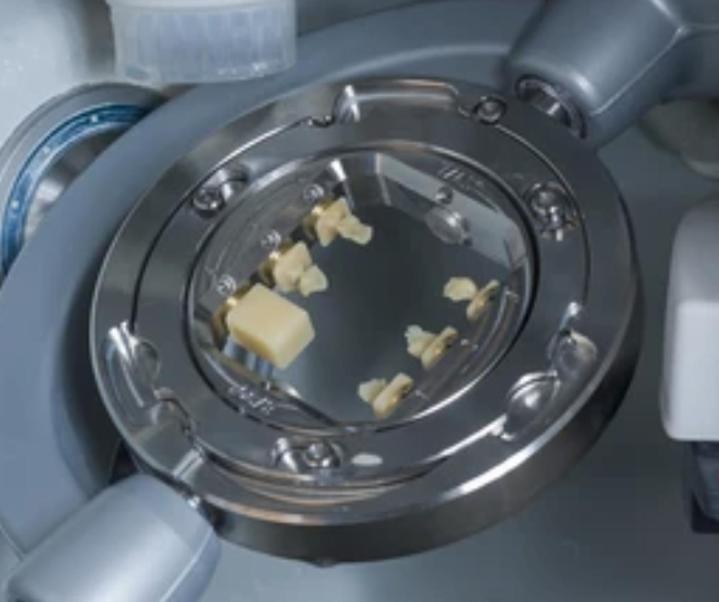 Implant dentaire céramique Castelnau-le-Lez